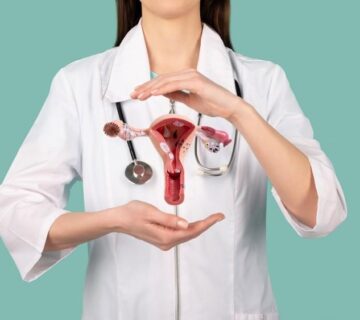 سندرم تخمدان پلی کیستیک