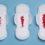 خونریزی یا لوشیا