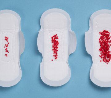 خونریزی یا لوشیا