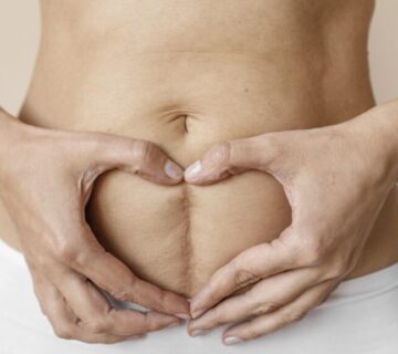 درد زير شکم بعد از زايمان طبيعی