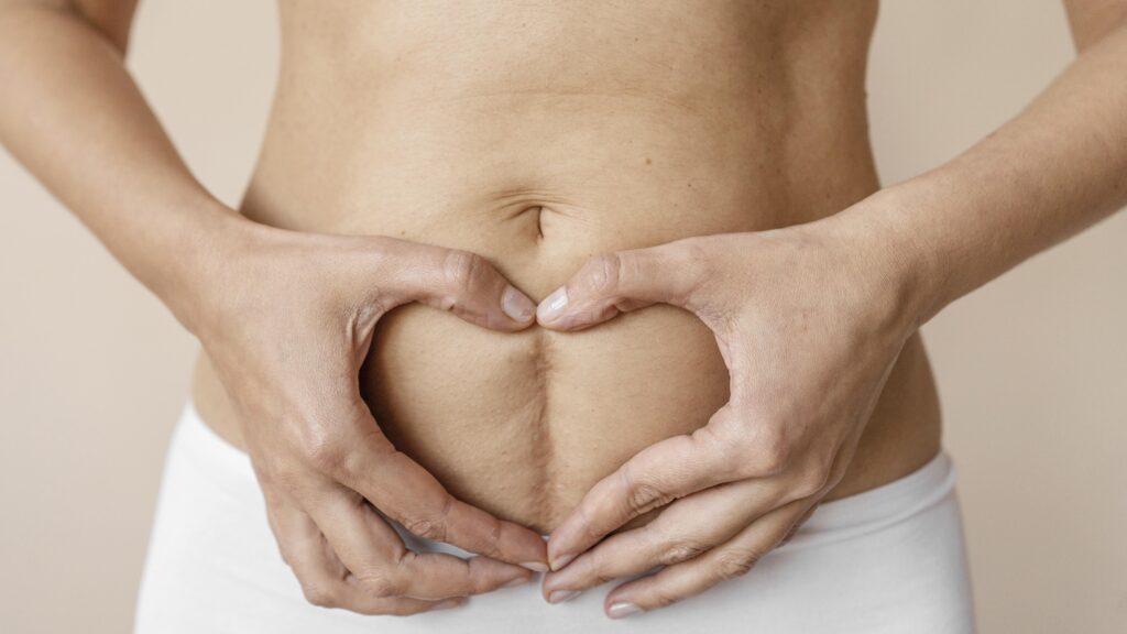 درد زير شکم بعد از زايمان طبيعی