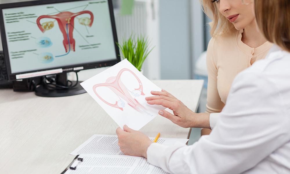 کیست درموئید تخمدان