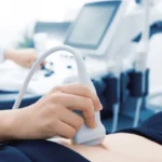 سونوگرافی رحم و تخمدان