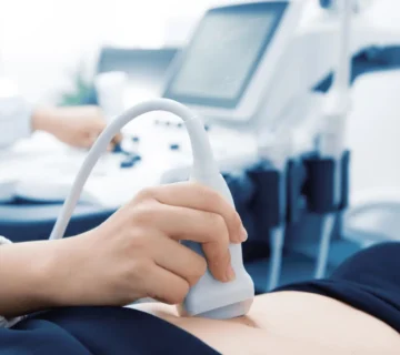 سونوگرافی رحم و تخمدان