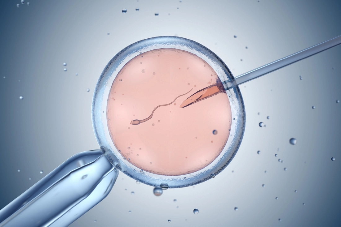 عکس IVF